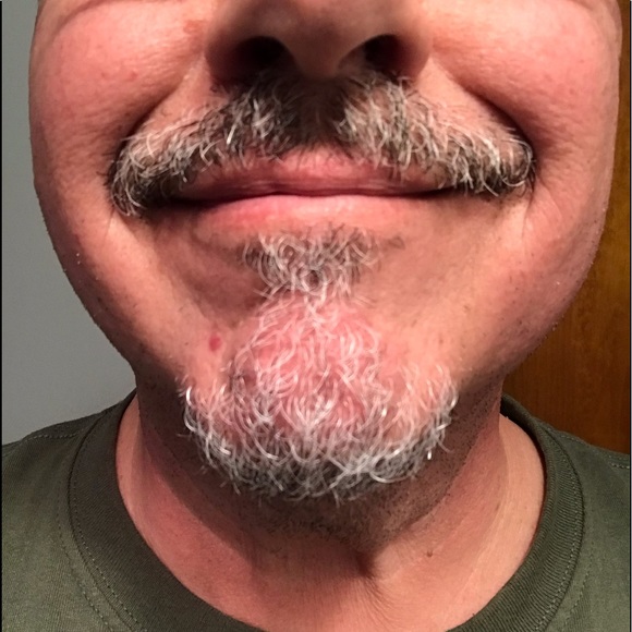 Meet your Posher, James - Picture 1 of 1